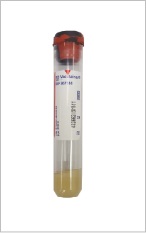 BD 8.5 mL SST (Tiger Red/Black)