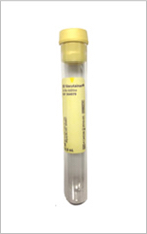 Urine Transfer Tube 10 mL (Yellow Top)