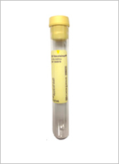 Urine Transfer Tube 10 mL (Yellow Top)