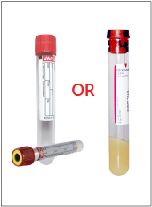 BD 8.5 mL SST (Tiger Red/Black)